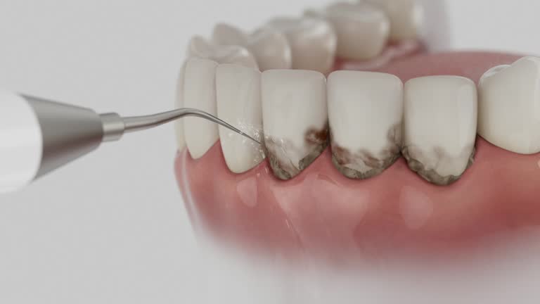 Trusted Root Canal Treatment service in Malakoff, TX - Dentist Open Now